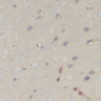 NUMB Rabbit Polyclonal Antibody