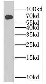 NUMBL Rabbit Polyclonal Antibody