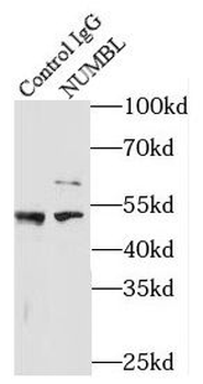 NUMBL Rabbit Polyclonal Antibody