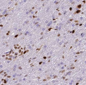 NUMBL Rabbit Polyclonal Antibody