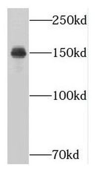 NUP160 Rabbit Polyclonal Antibody