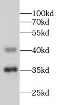 NUP35 Rabbit Polyclonal Antibody