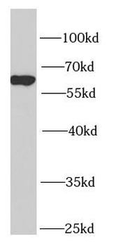 NUP62 Rabbit Polyclonal Antibody