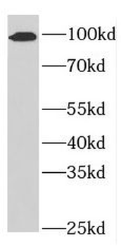 NUP98 Rabbit Polyclonal Antibody