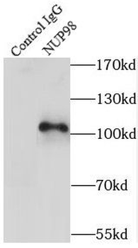 NUP98 Rabbit Polyclonal Antibody