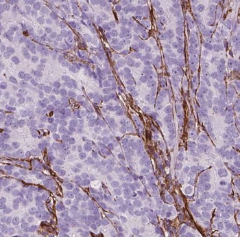 NUSAP1 Rabbit Polyclonal Antibody