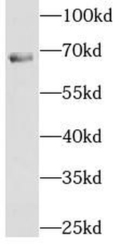 NXF1 Rabbit Polyclonal Antibody