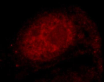 NXF1 Rabbit Polyclonal Antibody