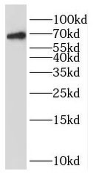 OAS2 Rabbit Polyclonal Antibody