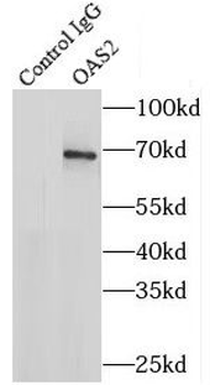 OAS2 Rabbit Polyclonal Antibody