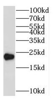 NABP1 Rabbit Polyclonal Antibody
