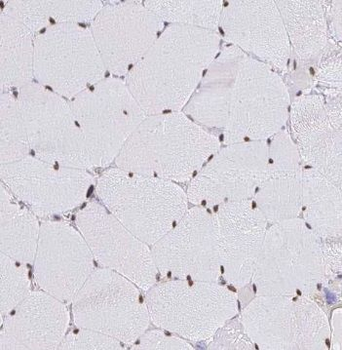 OBSCN Rabbit Polyclonal Antibody