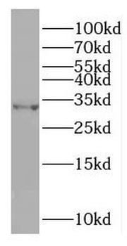 OCIAD1 Rabbit Polyclonal Antibody