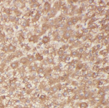 OCIAD1 Rabbit Polyclonal Antibody