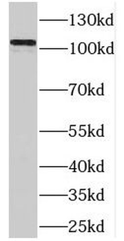 OCRL Rabbit Polyclonal Antibody