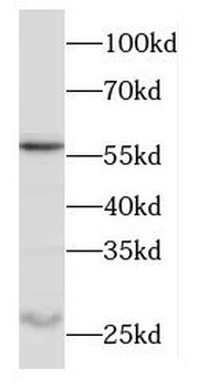 ODF1 Rabbit Polyclonal Antibody