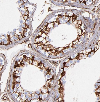 ODF1 Rabbit Polyclonal Antibody