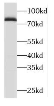 ODF2 Rabbit Polyclonal Antibody