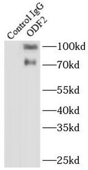 ODF2 Rabbit Polyclonal Antibody