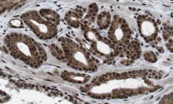CIMAP1A Rabbit Polyclonal Antibody