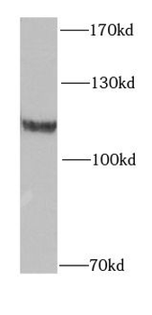 OGDH Rabbit Polyclonal Antibody