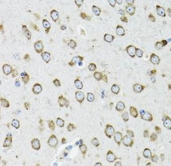 OGDH Rabbit Polyclonal Antibody