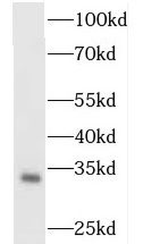 OGFOD2 Rabbit Polyclonal Antibody