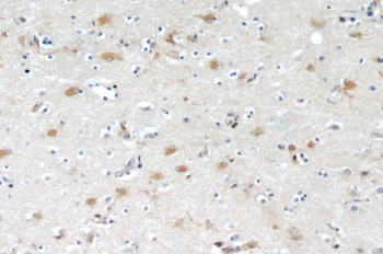 OGFOD2 Rabbit Polyclonal Antibody