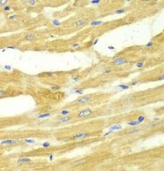 OGT Rabbit Polyclonal Antibody