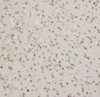 OLIG2 Antibody