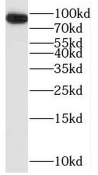 OPHN1 Rabbit Polyclonal Antibody