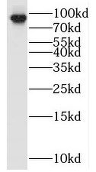 OPHN1 Rabbit Polyclonal Antibody