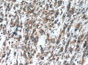 OPHN1 Rabbit Polyclonal Antibody