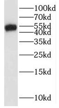 ONECUT1 Rabbit Polyclonal Antibody