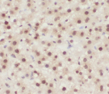 ONECUT1 Rabbit Polyclonal Antibody