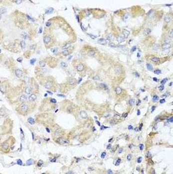 OPA3 Rabbit Polyclonal Antibody