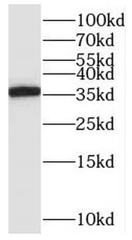 ORAI2 Rabbit Polyclonal Antibody