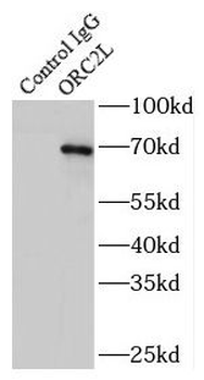 ORC2 Rabbit Polyclonal Antibody