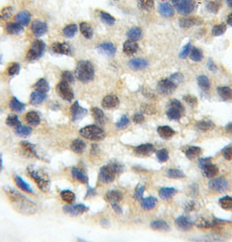 ORC5 Rabbit Polyclonal Antibody