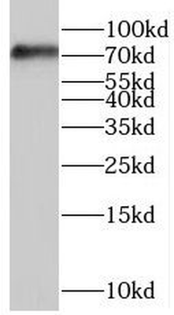 OS9 Rabbit Polyclonal Antibody