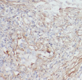 OS9 Rabbit Polyclonal Antibody