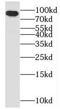 OSBP Rabbit Polyclonal Antibody