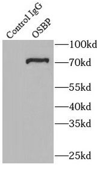 OSBP Rabbit Polyclonal Antibody