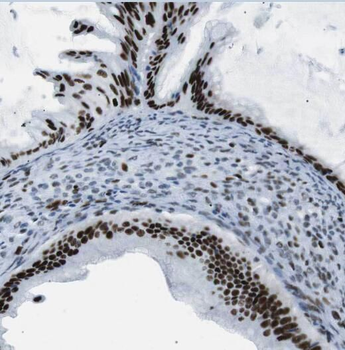 OSBP Rabbit Polyclonal Antibody