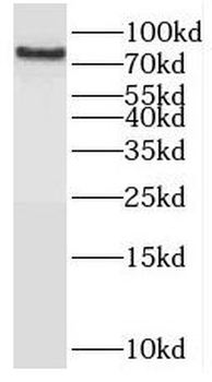 OSBPL10 Rabbit Polyclonal Antibody