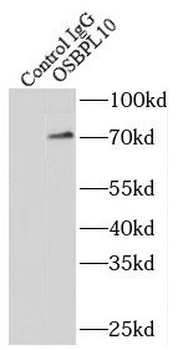 OSBPL10 Rabbit Polyclonal Antibody