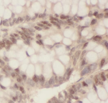 OSBPL10 Rabbit Polyclonal Antibody