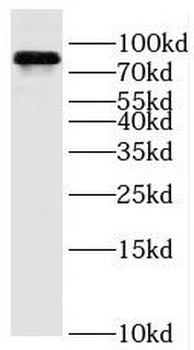 OSBPL11 Rabbit Polyclonal Antibody