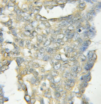 OSBPL11 Rabbit Polyclonal Antibody