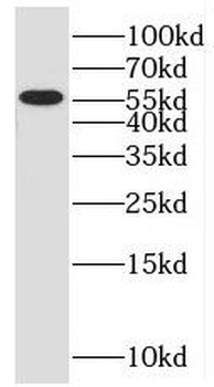 OSBPL2 Rabbit Polyclonal Antibody